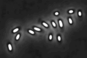Esporas vistas al microscopio.